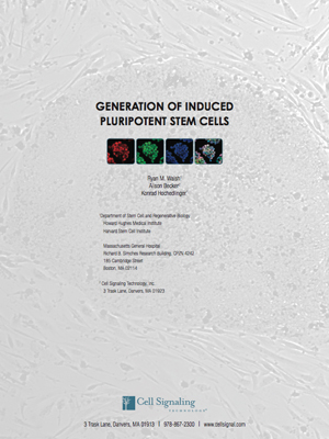 Stem_cell_WP_300x400