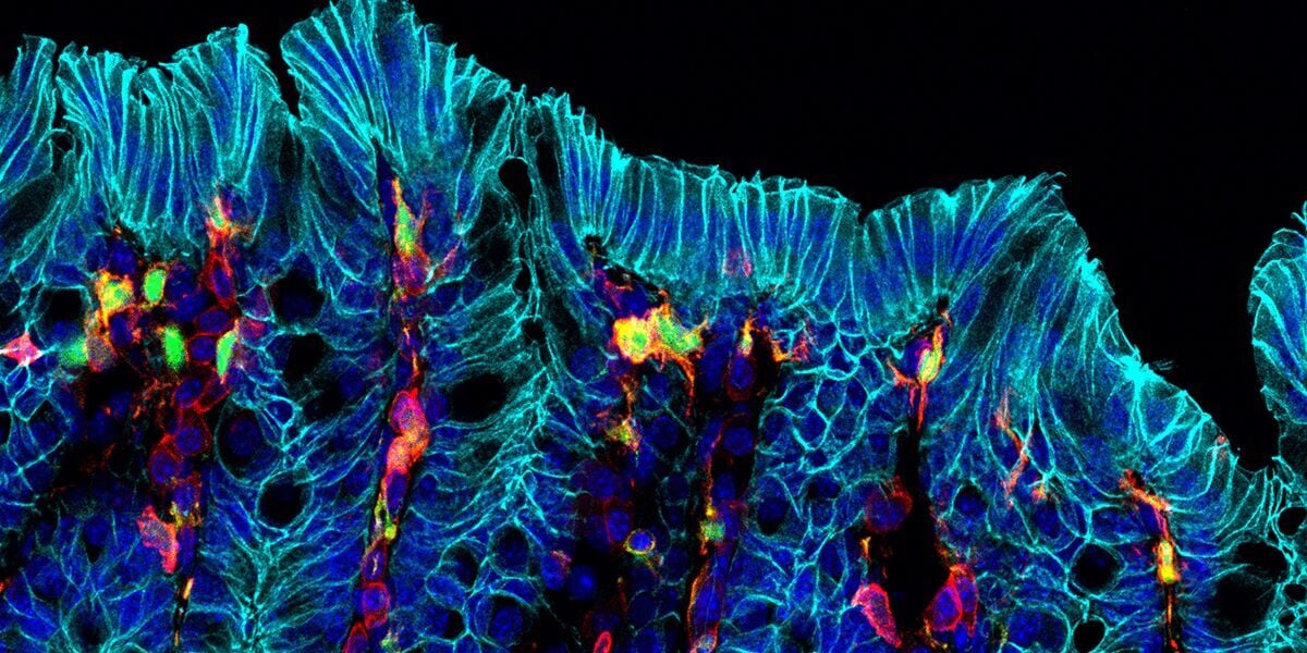 Multiplex immunofluorescence image of small intestinal tissue showing villus architecture, epithelial structures, cell nuclei, and multiple biomarker signals. Multiplex immunofluorescence image of small intestinal tissue showing villus architecture, epithelial structures, cell nuclei, and multiple biomarker signals.