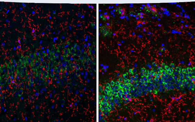 IF analysis of fixed frozen mouse hippocampus from wild-type or an amyloid mouse model of Alzheimer's disease