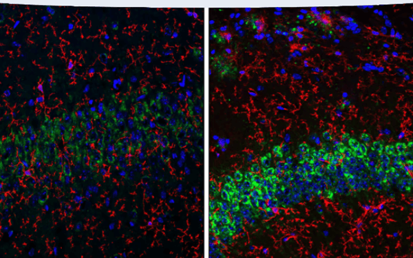 IF analysis of fixed frozen mouse hippocampus from wild-type or an amyloid mouse model of Alzheimer's disease