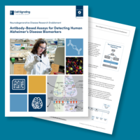 Antibody-Based Assays for Detecting Human Alzheimer's Disease Biomarkers Brochure