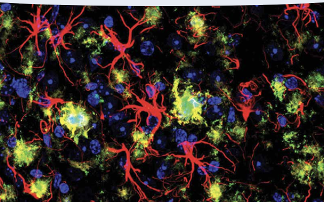 Neurodegeneration Drug Development