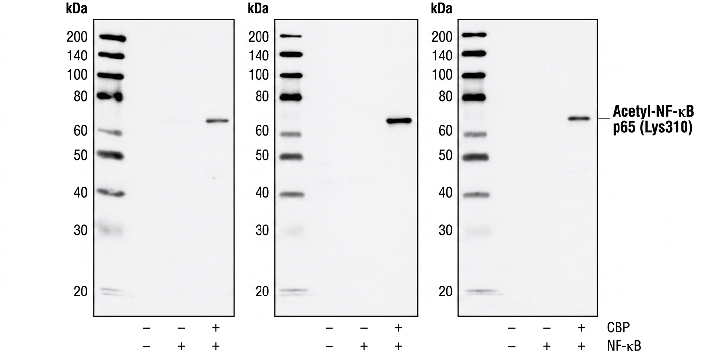 Western blot analysis of extracts from HeLa cells, mock transfected or transfected with NF-κB or NF-κB plus CBP, using Acetyl-NF-κB (Lys310) Antibody. Western blots were competed with acetylated peptide (middle) or non-acetylated peptide (right). Western blot analysis of extracts from HeLa cells, mock transfected or transfected with NF-κB or NF-κB plus CBP, using Acetyl-NF-κB (Lys310) Antibody. Western blots were competed with acetylated peptide (middle) or non-acetylated peptide (right).