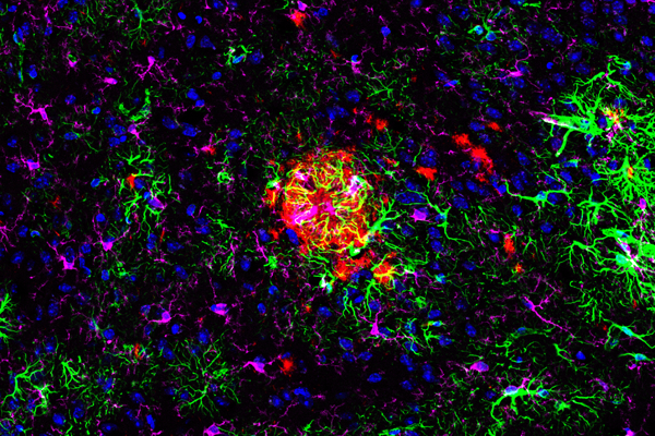 Confocal IF analysis of Tg2576 brain overexpressing human APP695. Samples were labeled with GFAP (E6N9L) Mouse mAb (green, mouse IgG2a), β-Amyloid (D3D2N) Mouse mAb #15126 (red, mouse IgG1), and HS1 (D5A9) XP® Rabbit mAb (Rodent Specific) #3892 (magenta, rabbit IgG), and DAPI #8961 (blue).
