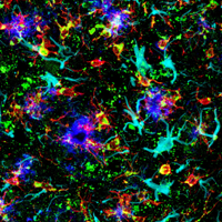 Fixed frozen brain from an amyloid mouse model of Alzheimer’s probed with the ready-to-use conjugated antibodies described above.