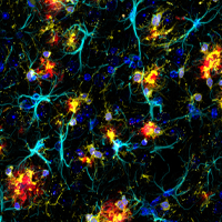 Fixed frozen brain from an amyloid mouse model of Alzheimer’s probed with the ready-to-use conjugated antibodies described above.