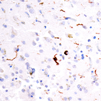 Tau (GT-38) Mouse Monoclonal Antibody #66850