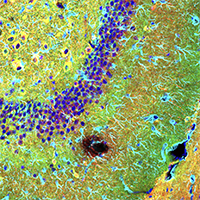 Confocal immunofluorescent analysis of fixed frozen mouse hippocampus, labeled with Phospho-Tau(Thr205)(E9A7P), GFAP, β3-Tubulin, DAPI.