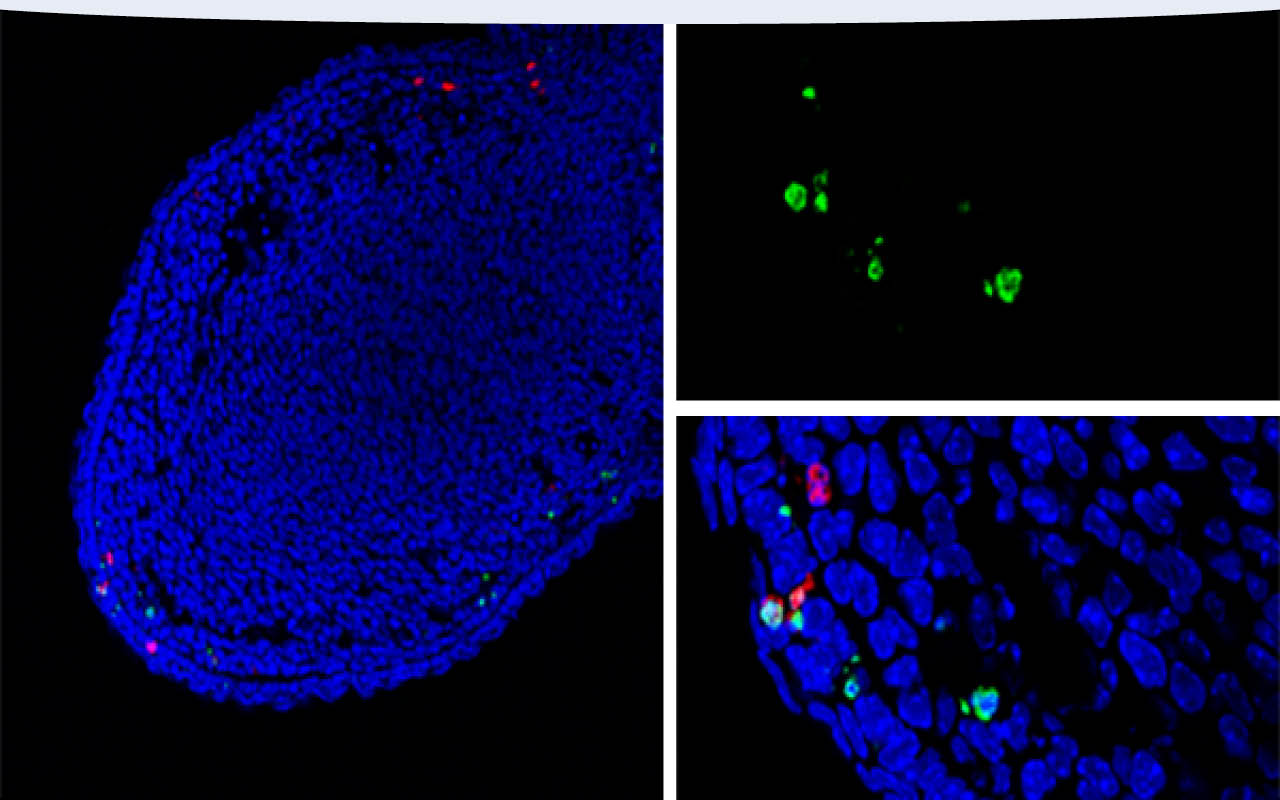 Confocal analysis of a fixed frozen E14.5 mouse digit at low magnification and high magnification using TUNEL Assay Kit (Fluorescence, 488 nm) followed by staining with Cleaved Caspase-3 (Asp175) (5A1E) Rabbit mAb #9664 and DAPI #4083.