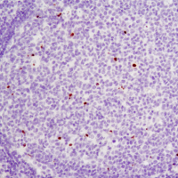 Immunohistochemical analysis of paraffin-embedded human tonsil using Cleaved PARP (Asp214) antibody.