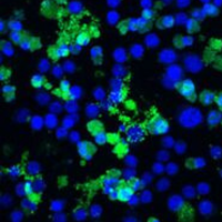 Confocal immunofluorescent analysis of Raw 264.7 cells, treated with TNF-α and Cycloheximide, using Cleaved Caspase-8 (Asp387) (D5B2) XP® Rabbit mAb  and DRAQ5® #4084 (fluorescent DNA dye).
