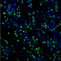 Confocal analysis of paraffin-embedded HT-29 xenograft using TUNEL Assay Kit (Fluorescence, 488 nm) and DAPI #4083.