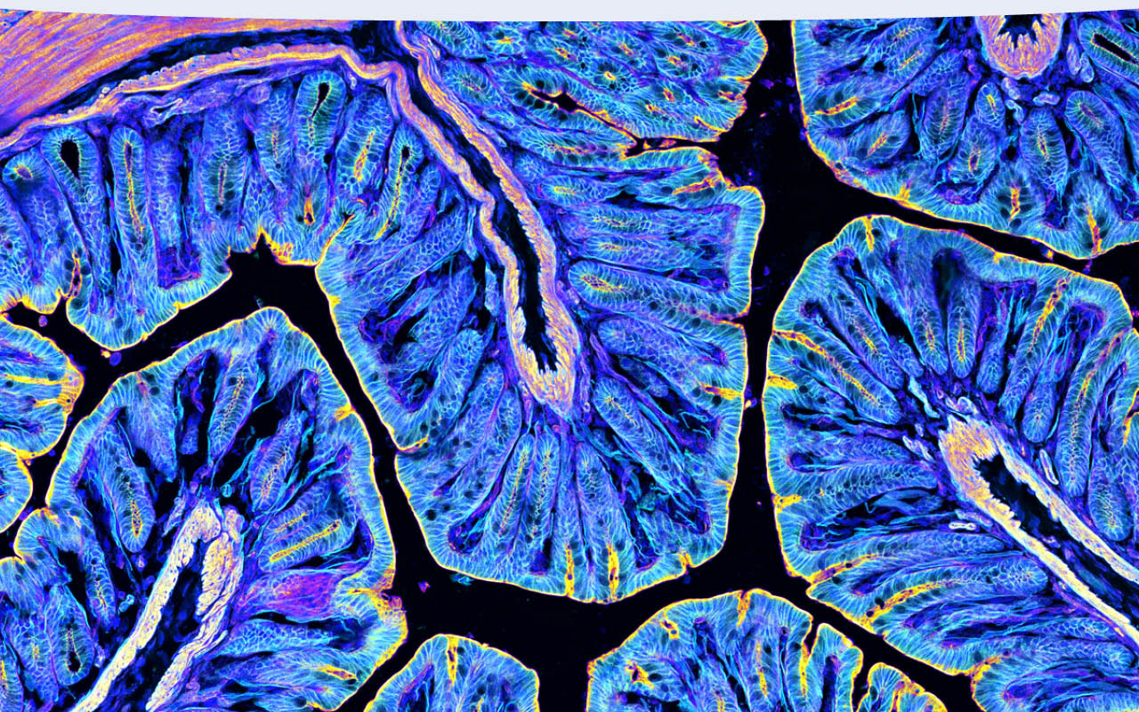 Immunofluorescence microscopy image of folded biological tissue.