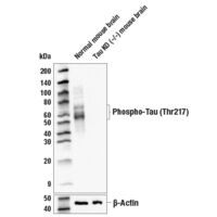Western blot analysis of extracts from normal mouse brain and Tau KO (- /-) mouse brain tissue using Phospho-Tau (Thr217) (E9Y4S) Rabbit mAb or β-Actin (D6A8) Rabbit mAb #8457.
