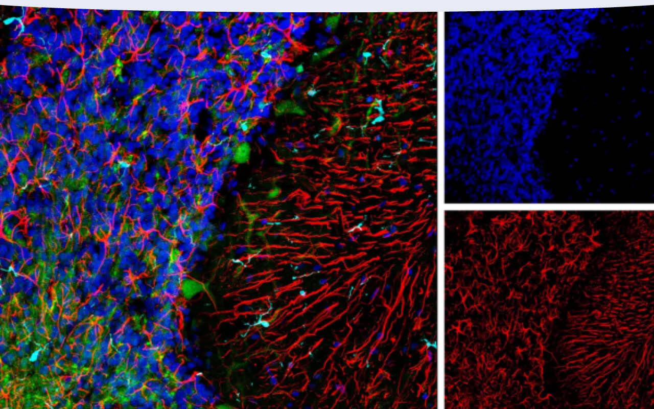 IF analysis of rat cerebellum using UCHL1 (D3T2E) XP ® Rabbit mAb #13179 and GFAP (E8S7G) Mouse mAb #95717. After blocking free secondary antibody binding sites with Rabbit (DA1E) mAb IgG XP ® Isotype Control #3900, the tissue was then labeled using Iba1/AIF-1 (E4O4W) XP ® Rabbit mAb (Alexa Fluor ® 647 Conjugate) #78060 and ProLong ® Gold Antifade Reagent with DAPI #8961.