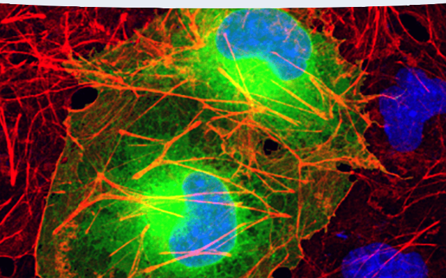 Immunofluorescence analysis visualizing different subcellular markers.