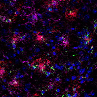 IF analysis of fixed frozen brain from an amyloid mouse model of Alzheimer's disease using chimeric CD68 (feline) and TMEM119 (mouse) antibodies, and β-Amyloid rabbit primary antibody.