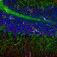 Confocal immunofluorescent analysis of fixed frozen mouse cerebellum.