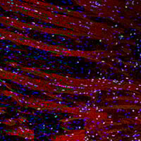 Confocal immunofluorescent analysis of fixed frozen mouse striatum.