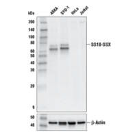 Western blot analysis of extracts from various cell lines using SS18-SSX (E9X9V) XP® Rabbit mAb (upper) or β-Actin (D6A8) Rabbit mAb #8457 (lower).