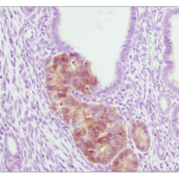 Immunohistochemical analysis of paraffin-embedded PTEN heterozygous mutant mouse endometrium using Phospho-Akt (Ser473) antibody.