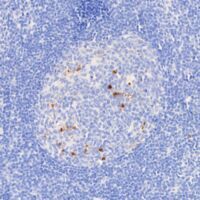 Immunohistochemical analysis using Cleaved Caspase-3 (Asp175) (D3E9) Rabbit mAb #9579 