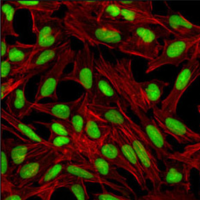 Immunofluorescent analysis of untreated HeLa cells labeled with PARP (46D11) antibody.