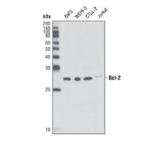 Western blot analysis of extracts from various cell lines using Bcl-2 antibody.