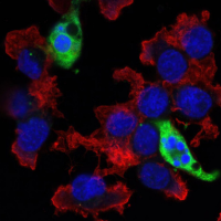 Confocal immunofluorescence images of HT-29 cells, untreated (left) or Staurosporine #9953 treated (right) labeled with Cleaved Caspase-3 (Asp175) (5A1E) Rabbit mAb (green). 