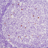 Immunohistochemical analysis of paraffin-embedded human tonsil using Cleaved PARP (Asp214) antibody.
