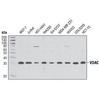 Western blot analysis of extracts from various cell types using VDAC (D73D12) Rabbit mAb.