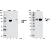 Western blot with Phospho-Stat3 (Tyr705) (D3A7) XP® Rabbit mAb #9145