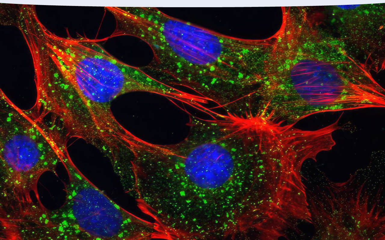 IF analysis of mouse embryonic fibroblast cells using mTOR antibody