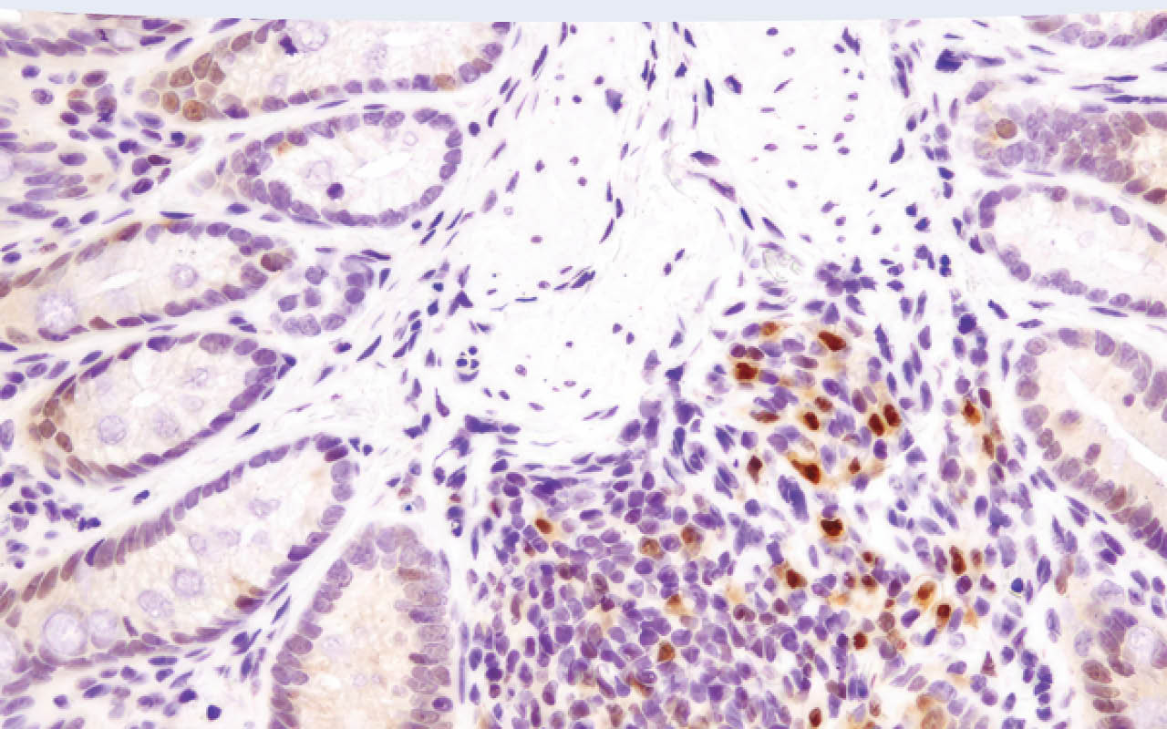 Immunohistochemical analysis of paraffin-embedded mouse colon using Phospho-p38 MAPK (Thr180/Tyr182) (D3F9) XP® Rabbit mAb.