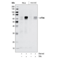 Western blot analysis of extracts from HeLa and H-4-II-E cells serum-starved overnight and TPA-stimulated for 4 hours, using c-Fos (9F6) Rabbit mAb.