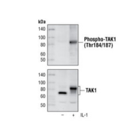 Western blot analysis of extracts from 293 IL-1R cells, untreated and treated for 10 minutes with IL-1, using Phospho-TAK1 (Thr184/187) (90C7) Rabbit mAb and TAK1 Antibody #4505.