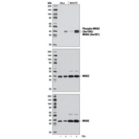 Western blot analysis of extracts from HeLa and NIH/3T3 cells, untreated (-) and treated with TPA #4174 (200 nM, 15 min; +), using Phospho-MKK3 (Ser189)/MKK6 (Ser207) (D8E9) Rabbit mAb, MKK3 (D4C3) Rabbit mAb #8535, and MKK6 (D31D1) Rabbit mAb #8550.