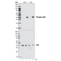 Western blot analysis of extracts from COS and 293 cells, untreated and UV-treated, using Phospho-p38 MAPK (Thr180/Tyr182) (D3F9) XP® Rabbit mAb and p38 MAPK Antibody #9212.