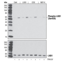 Western blot analysis of extracts from various cell lines, untreated and treated with TPA #9905 and UV, using Phospho-LKB1 (Ser428) (C67A3) Rabbit mAb and LKB1 (D60C5) Rabbit mAb #3047.
