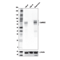 Western blot analysis of extracts from LNCaP and SNB-19 cells and mouse brain using CaMKK2 (D8D4D) Rabbit mAb and β-Actin (D6A8) Rabbit mAb #8457.
