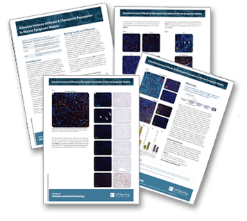 immune-infiltrate-checkpoint-proteins-thumbnail immune-infiltrate-checkpoint-proteins-thumbnail