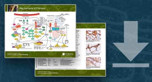 Mechanisms of Fibrosis