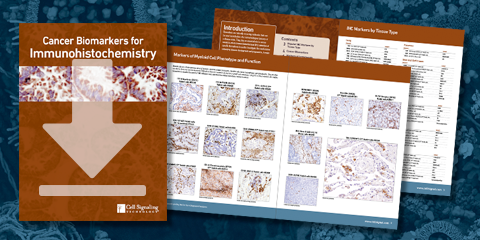 Download the Cancer Biomarker Guidebook for Immunohistochemistry Download the Cancer Biomarker Guidebook for Immunohistochemistry