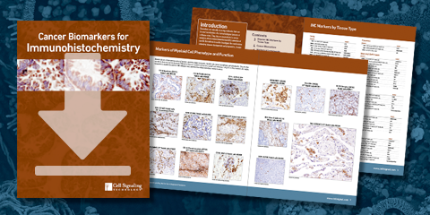 Download the Cancer Biomarker Guidebook for Immunohistochemistry