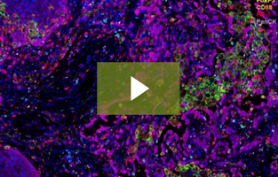 Multiplexing on Mouse Tissue Using CST Antibodies and OPAL IHC Method