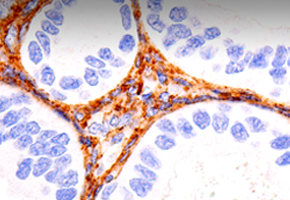 metastasis-products-module-1-image