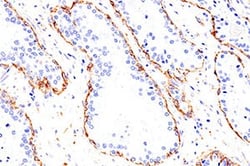 p75NTR (E7I3M) Rabbit mAb #41680