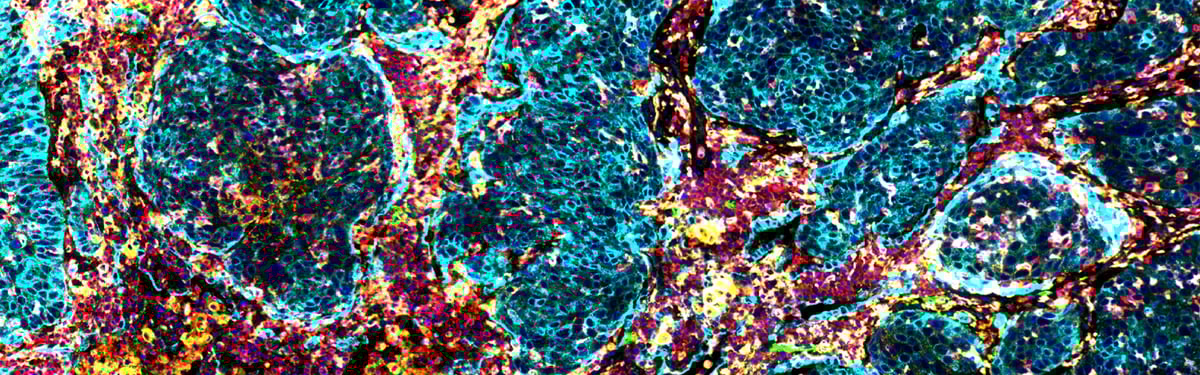 Leica-Myeloid cell_8plex on SCC_T37C-1600x500