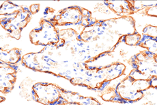 SLC40A1/Ferroportin-1 (F9U5S) Rabbit mAb #48322