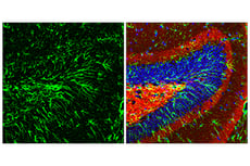 GFAP (E4L7M) XP® Rabbit mAb (Alexa Fluor® 488 Conjugate) #94242